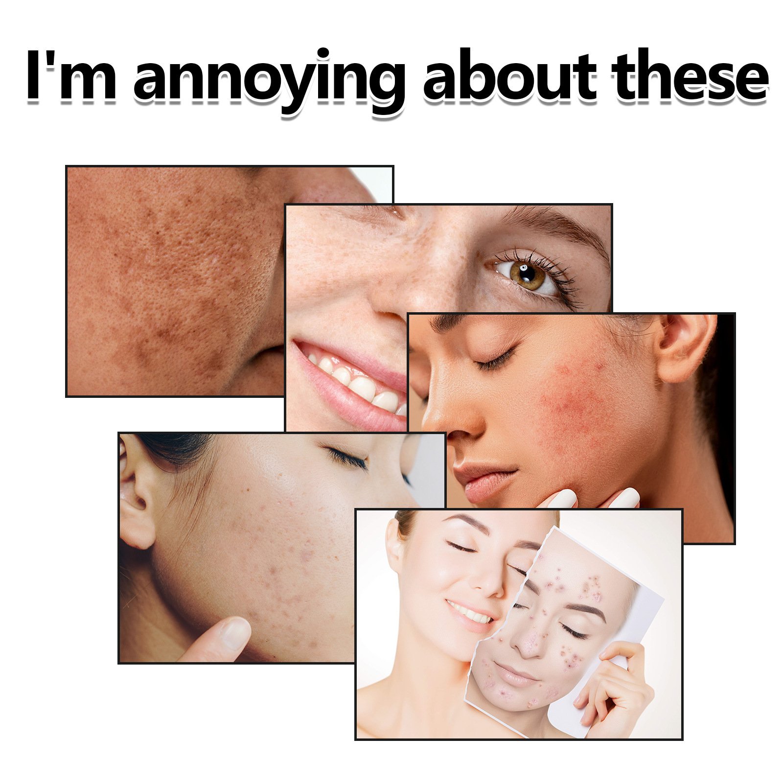 Gentle Exfoliating Toner for Skin Repair Hoygi - Image 5