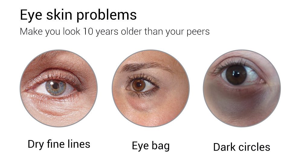 Breylee Eye Cream - Image 13